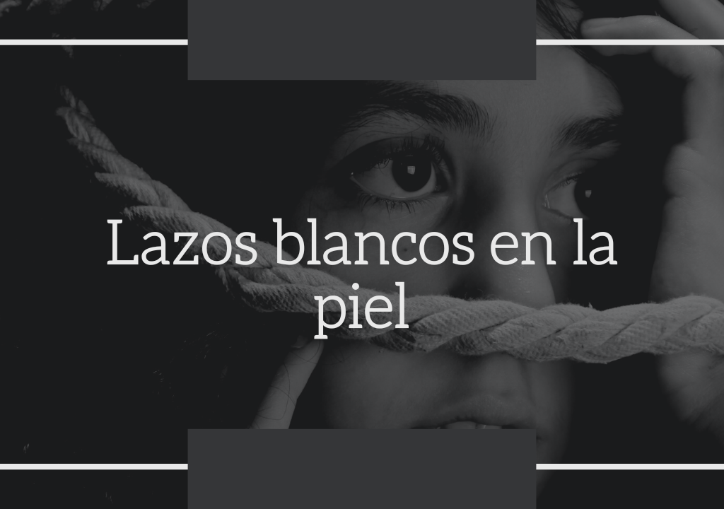 Lazos blancos en la piel